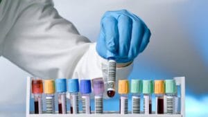 ما هي أهمية التحاليل المنزلية في متابعة الأمراض المزمنة؟