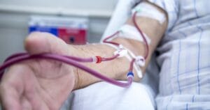 تكلفة غسيل الكلى في المنزل: هل هو خيار اقتصادي؟